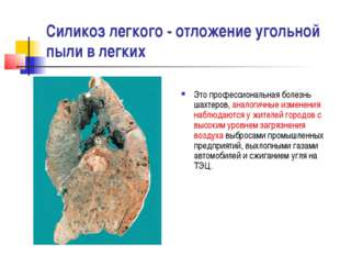 Силикоз легкого - отложение угольной пыли в легких Это профессиональная болез